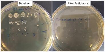bacteria after antibiotics
