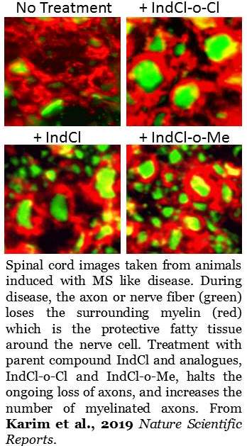 Spinal cord from animal model of MS