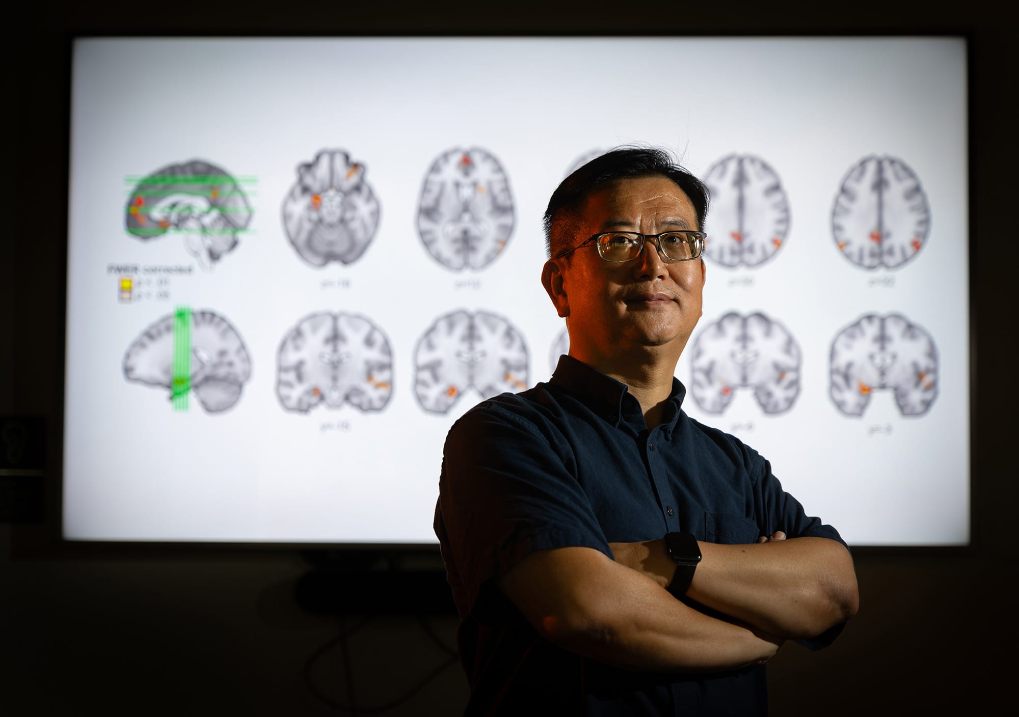 Weiwei Zhang’s work with functional MRI and noninvasive brain stimulation aims to connect hippocampal function with memory quality.