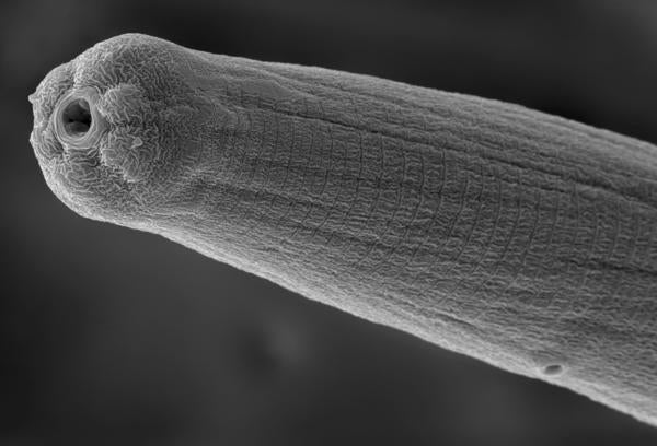 An activated Steinernema carpocapsae nematode