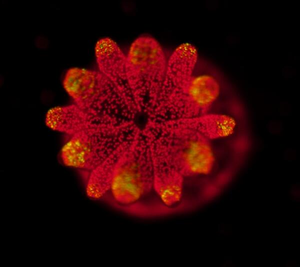 An enhanced photo shows algae has established itself throughout a sea anemone even without photosynthesis