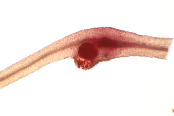 nematode releasing eggs