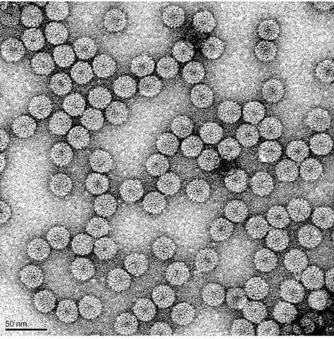 Brome Mosaic Virus particles