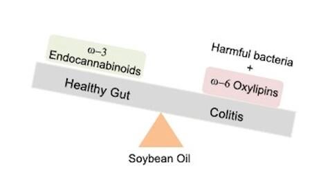 Soybean oil colitis