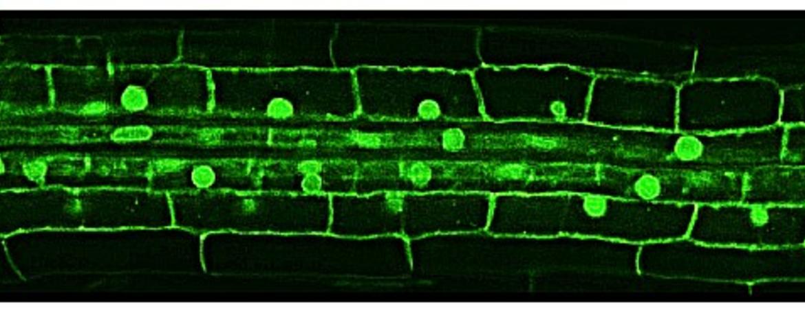 Cellular vision of a rice root - the green globes are nuclei