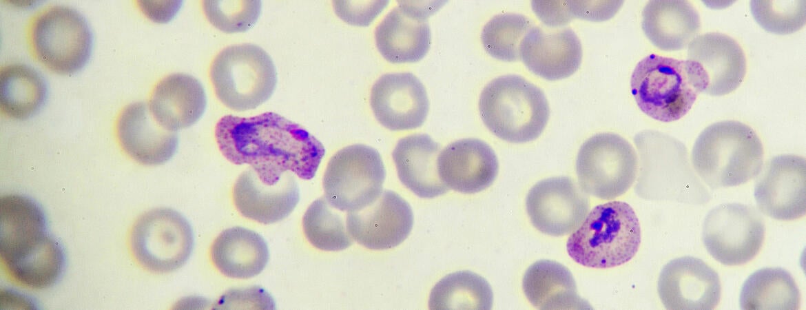 Malaria parasite in blood film
