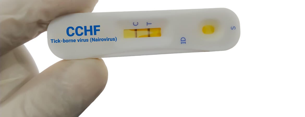 CCHFV