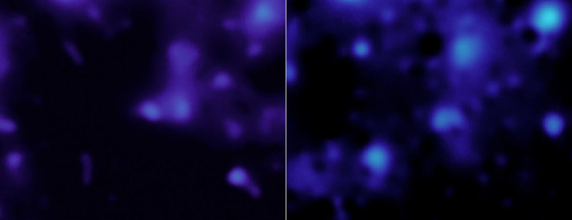 Dark matter Webb and Hubble images
