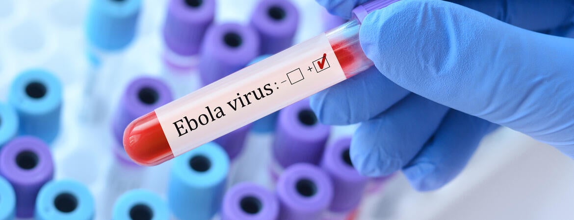 Ebola virus test