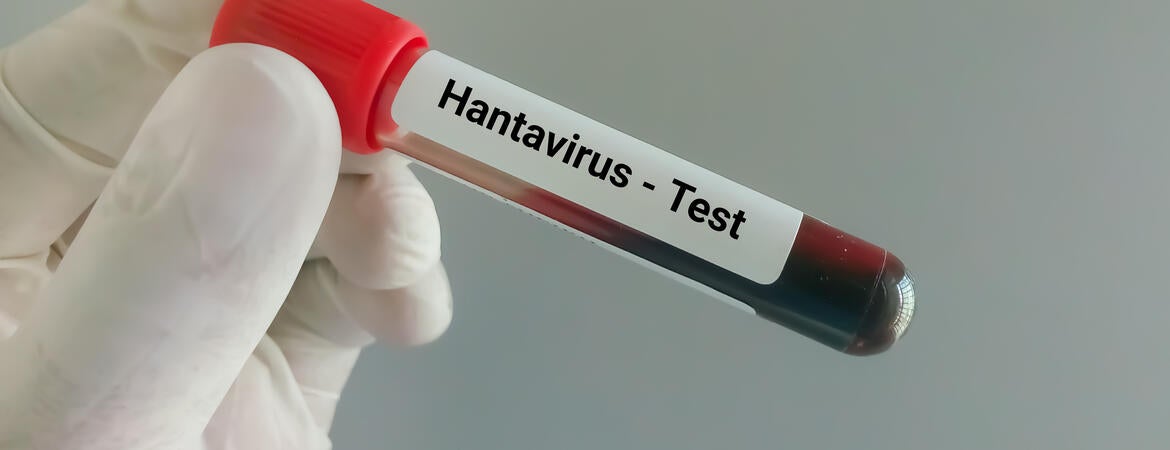 Blood sample for hantavirus test