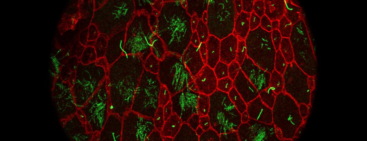 Primary cilia