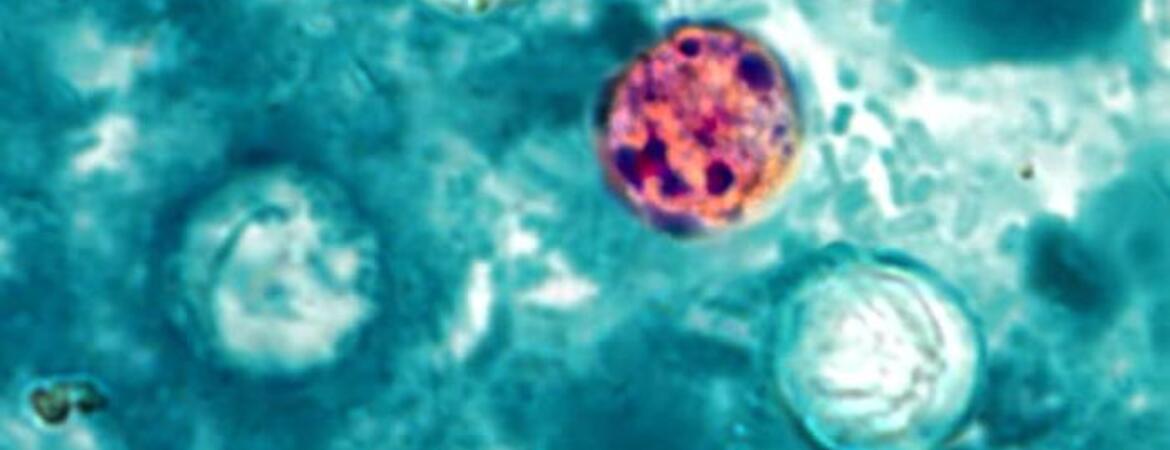 Cyclospora cayetanensis