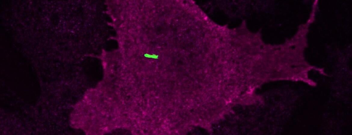 Cilium