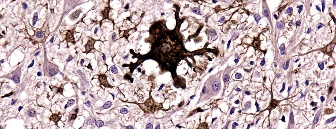 AI generated image of activated microglial cell in mouse brain