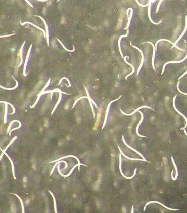 microscope image of new nematode species