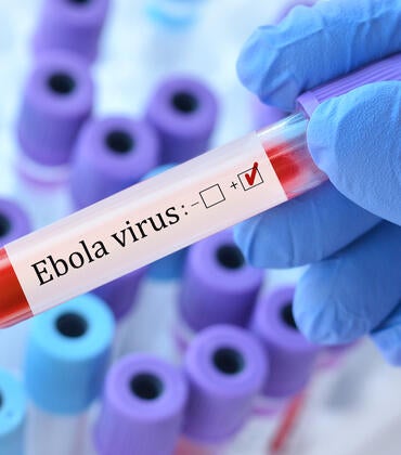 Ebola virus test