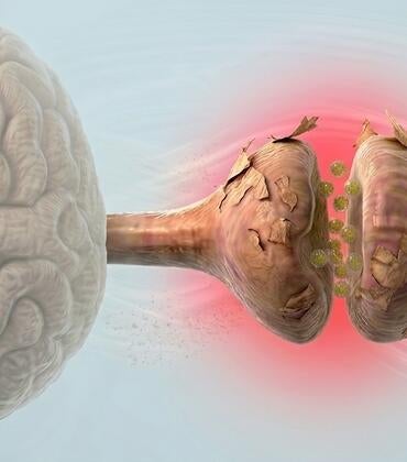 Traumatic brain injury