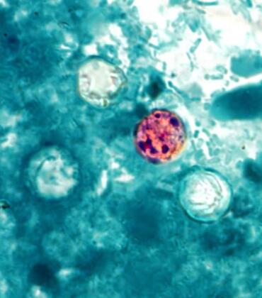 Cyclospora cayetanensis
