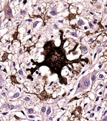 AI generated image of activated microglial cell in mouse brain