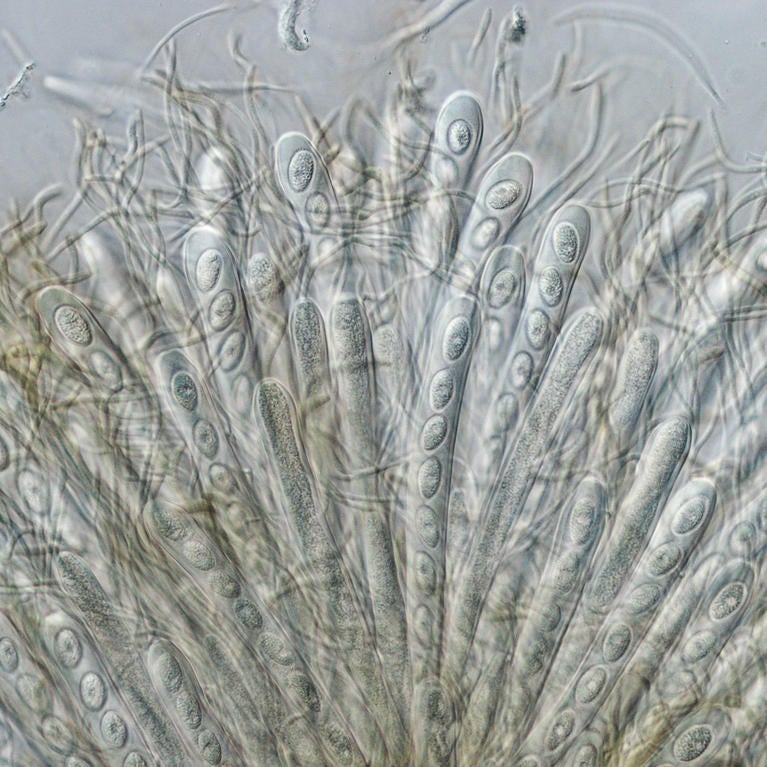 fungus microscopy