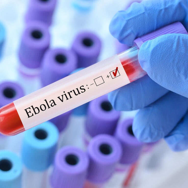 Ebola virus test