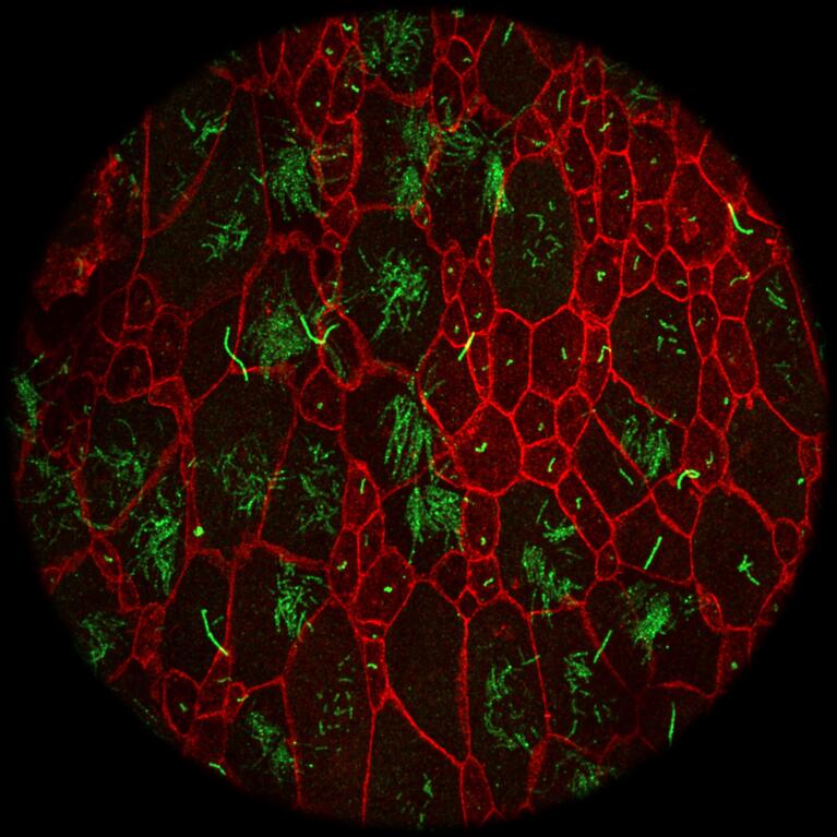 Primary cilia