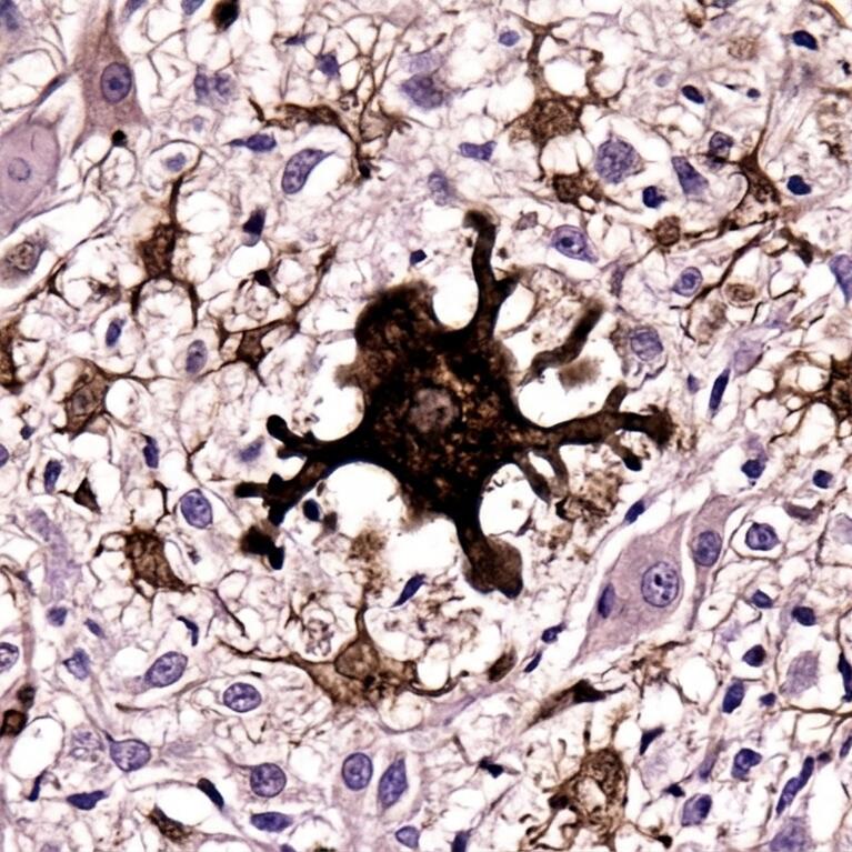 AI generated image of activated microglial cell in mouse brain