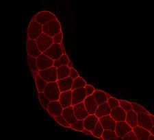 Fluorescence microscopy of the salivary gland in the fly larvae and highlights the localization of the steroid transporter on the cell membrane (Naoki Okamoto)