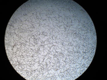 nematodes seen under a microscope