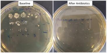 antibiotic effects bacteria after antibiotics