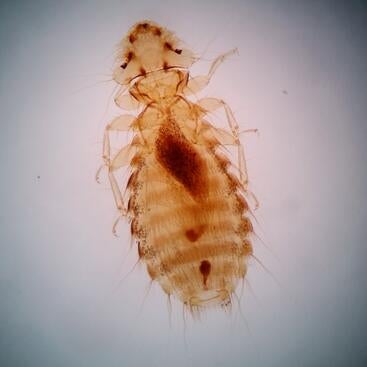 chicken louse