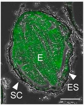 Cucumber mosaic virus