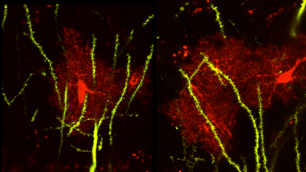Brain protein linked to seizures, abnormal social behaviors - UC Riverside