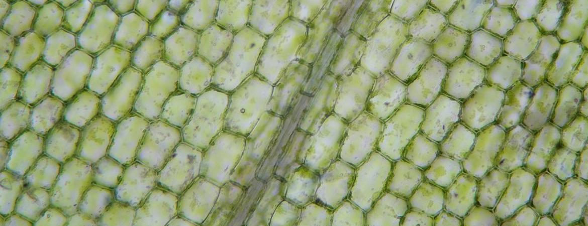 microscope image of plant cells