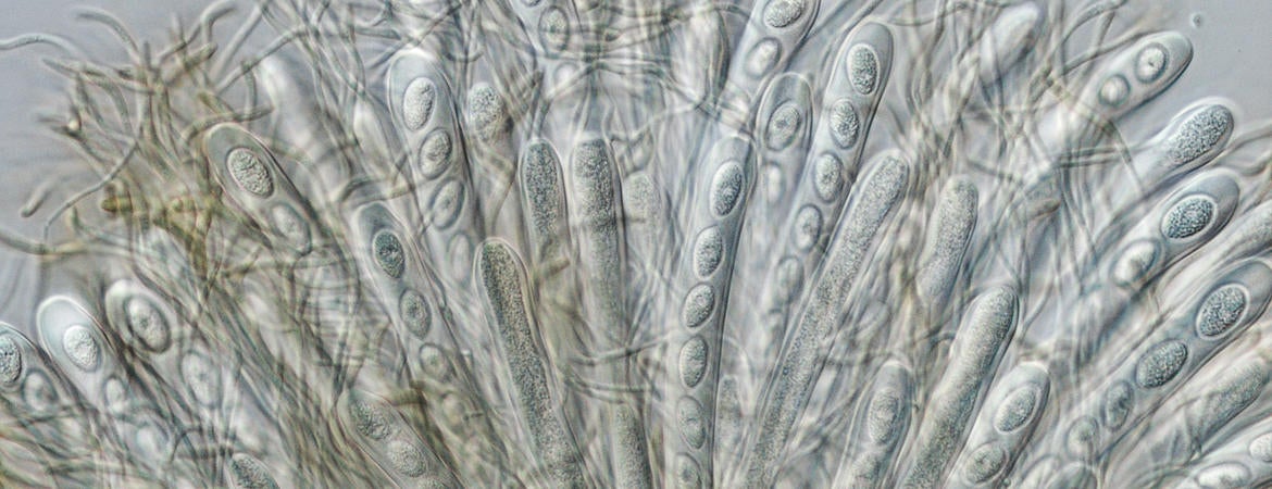 fungus microscopy